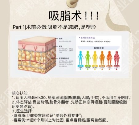 南方医科大学南方医院吸脂多少钱？腰腹吸脂1.3w起、小腿吸脂7k起