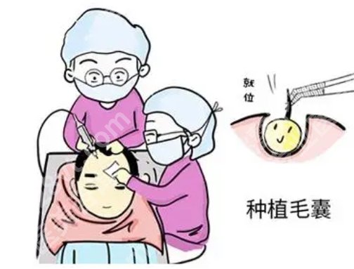 301医院植发挂什么科？相关科室信息|速看就诊指南~