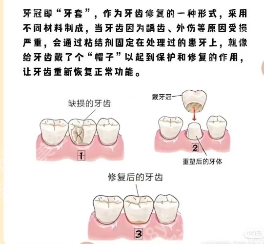 吉大一院牙科多少钱？院内服务好评度来袭！