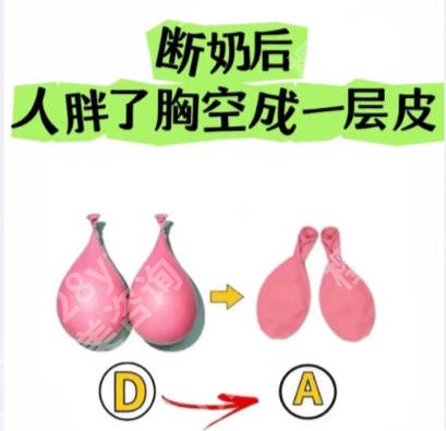 华西割双眼皮需要等多久？医院简介、真实口碑点评！流程公布！