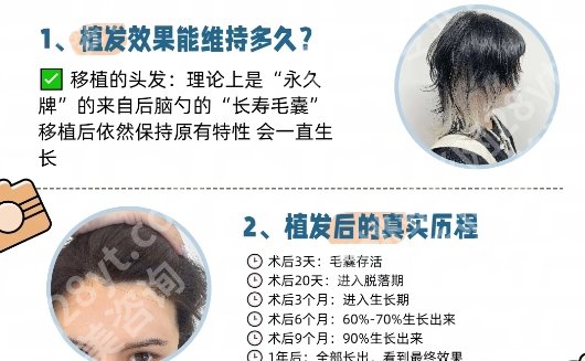 浙一植发挂什么科？植发专科专家解析！速速来看