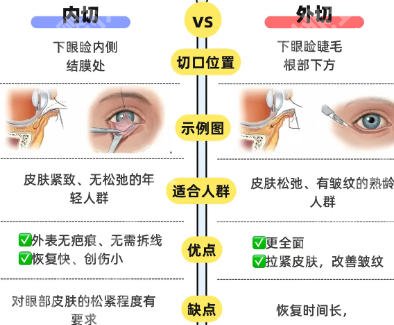 南方医院眼袋微创手术价格表更新！激光去眼袋低至1.1w起