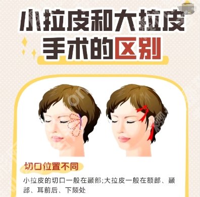 安徽省立医院除皱价格贵不贵？核心项目及技术优势点评！
