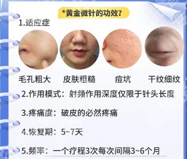 北医三院黄金微针价格公布！明细公开！无隐形消费