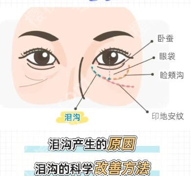 吉大一院脂肪填充泪沟价格贵不贵？2026价格与收费标准全新公布