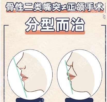 山东省立医院正颌手术价格贵吗?全程费用一次性说清!就诊必看