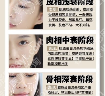 华西医院面部提升术多少钱？2026全新价格表展示！
