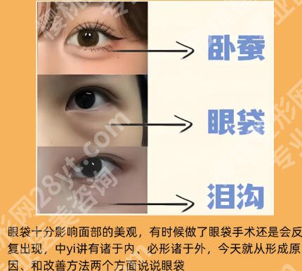 华西去眼袋手术费用大概多少钱？内切去眼袋9800元起！