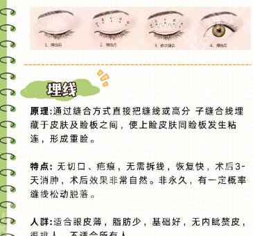 浙大二院整形科怎么样？做双眼皮技术如何？真实案例点评！