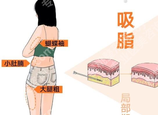 浙一医院整形科价目表一览，费用列表_医院优势严选