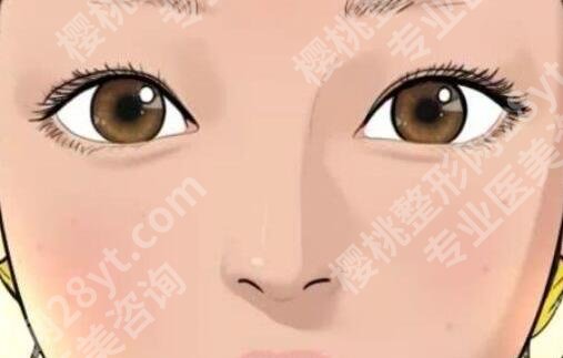 上海第二人民医院割双眼皮多少钱?11213元起,术前提前看