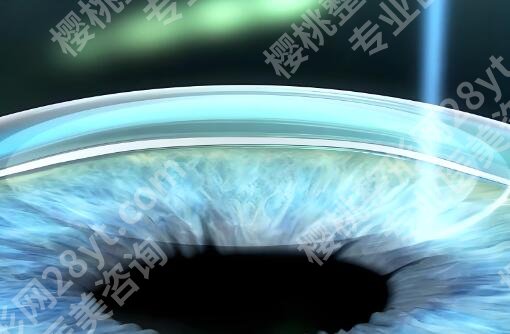 安徽省立医院眼科做手术咋样？明星项目查看，案例一一鉴赏