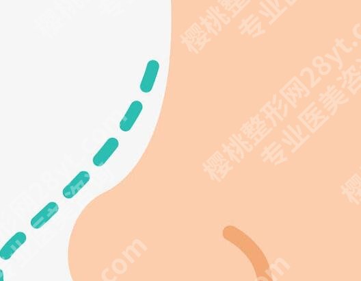 台州隆鼻医院盘点：本地正规机构实测整理，2026全新价目
