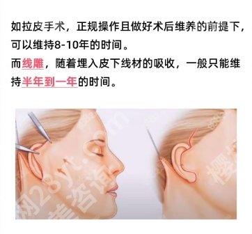 上海做拉皮手术好的医生有哪几位？丁伟、王衡健医生满意反馈度高！