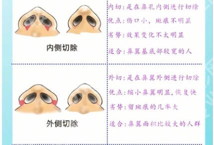 惠州哪个整形医院鼻修复好！五家技术扎实、口碑好！