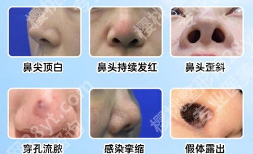 徐州鼻修复出名的医院有哪些？五家医院个个实力派！