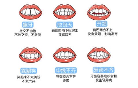 上海正畸牙齿哪家医院好？top5榜单公布！