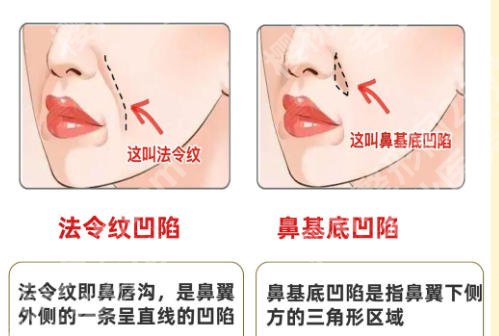 上海整形美容院哪家好点？五家医院榜上有名各家技术高超！