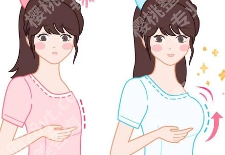 成都华西隆胸哪个医生好?资历和案例能说明问题
