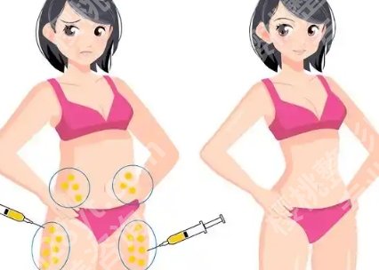 华西医院吸脂找哪个医生?这几位在求美者中评价持续稳定