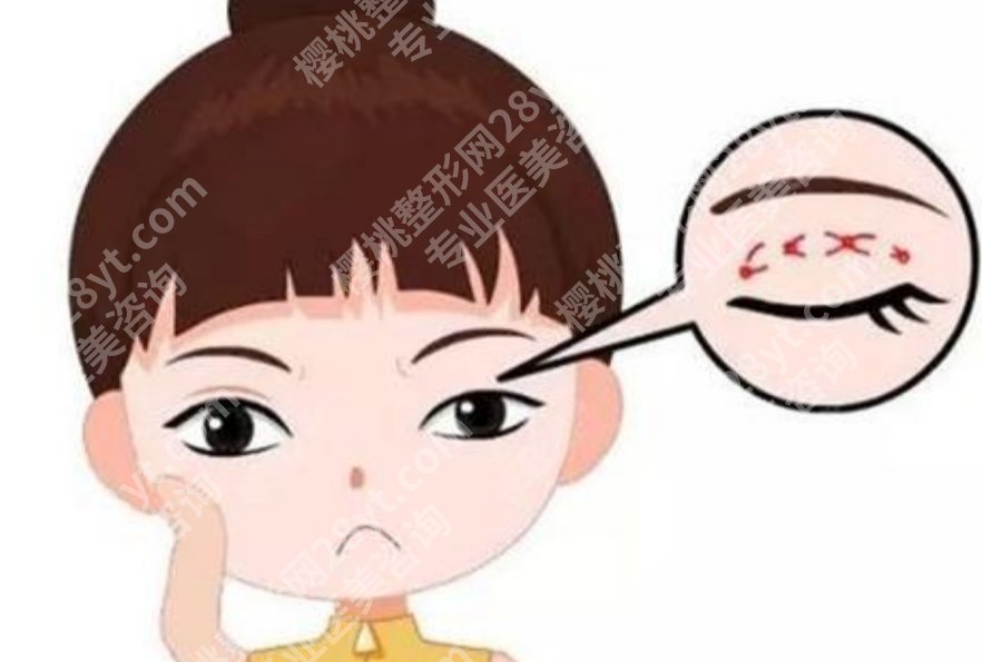 浙一医院双眼皮价格表，附埋线和切开的价格区间对比