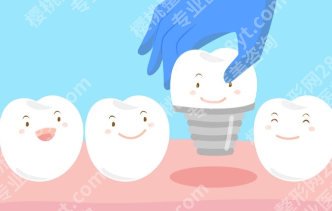 北医三院种牙多少钱?从检查到修复,花费路径讲清
