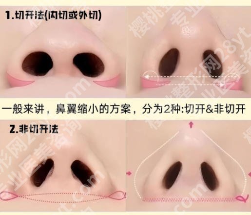 上海隆鼻专家前十名有哪些？这份专家榜单帮你选！