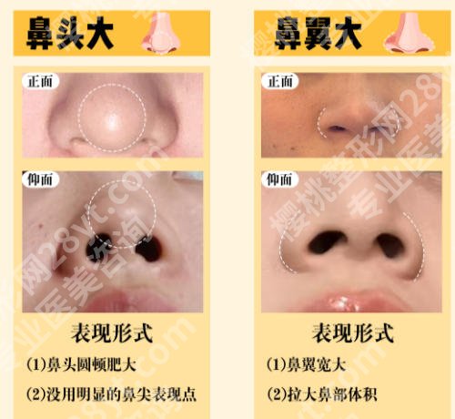 潍坊隆鼻十大医院排行榜公示！十家医院技术高超，值得信赖！