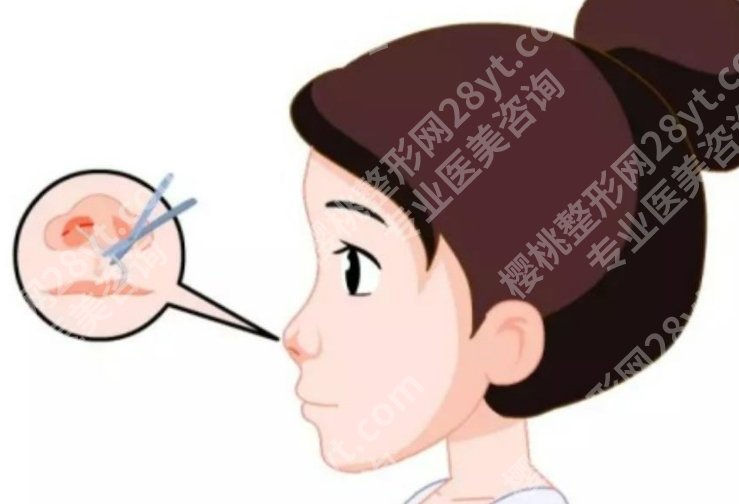 华西做隆鼻怎么样？团队经验与设计理念盘点
