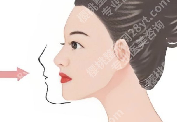 深圳北大医院正颌怎么样？技术特点与经验背景介绍