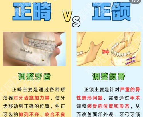 北京做正颌排名的医院有哪些？五家医院实力上榜！