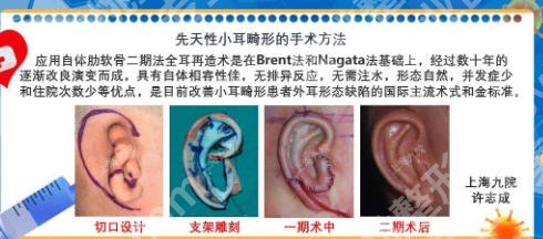 上海耳朵整形排行榜新鲜出炉！综合美学TOP医院！
