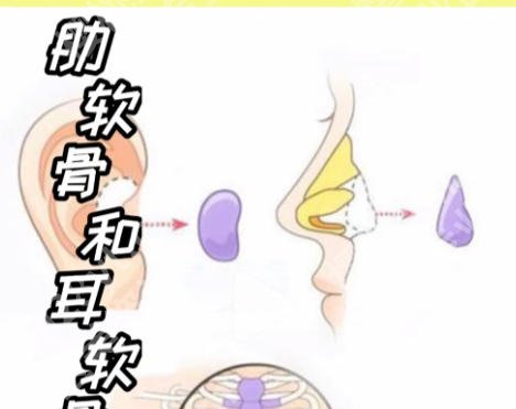 北京肋骨鼻前十名医生！尤建军、薛红宇、安阳等医生实力上榜！