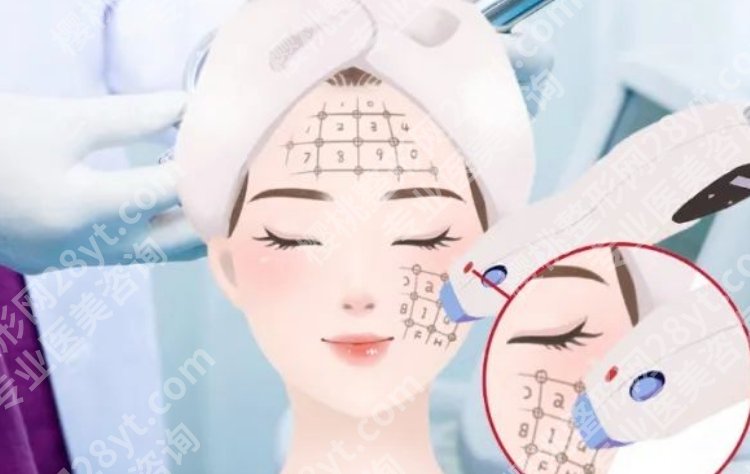 华西热玛吉哪个医生做的好？医生怎么选更适合自己的皮肤状态