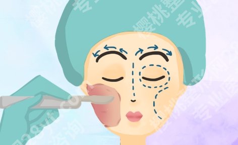 成都磨骨医生排行榜前十，这些关注度高的医生值得先了解