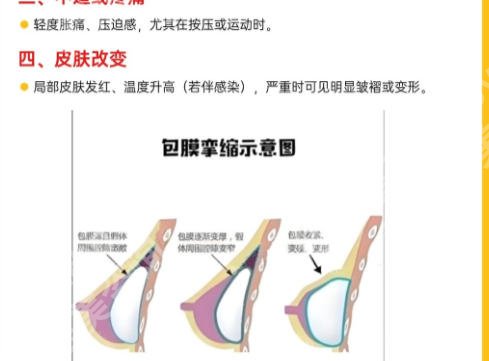 北京乳房整形医院排名前十排行榜单发布！TOP10优势、交互展示!