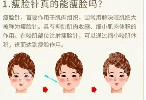 海口打瘦脸针哪家医院好?这些宝藏医院别错过!