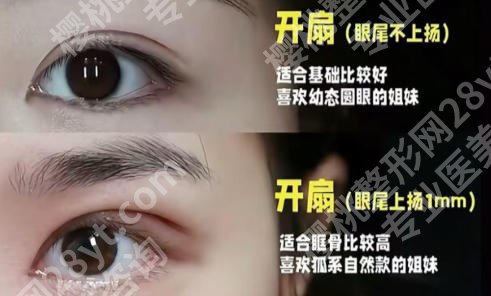 上海眼整形哪个医院好？口碑技术有保障，资料抢先看！