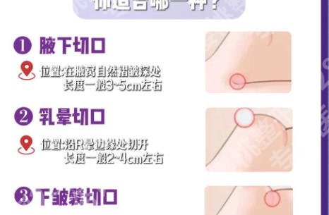 苏大附一院丰胸手术价格怎么样？价格及科室详情案例介绍
