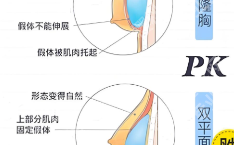 齐齐哈尔第一医院隆胸怎么样？真实案例大揭秘！