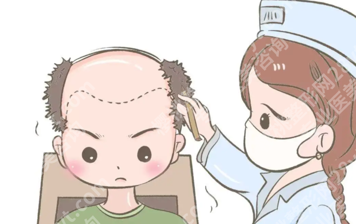 长春种植头发哪家医院好？发友真实反馈＋植发技术对比