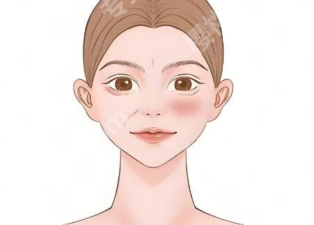 九院吸脂有失败的么？真实情况+避坑指南全揭秘