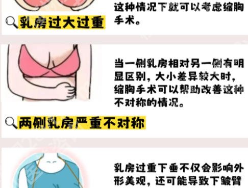 北京协和医院缩胸手术挂什么科室？专家来帮忙！