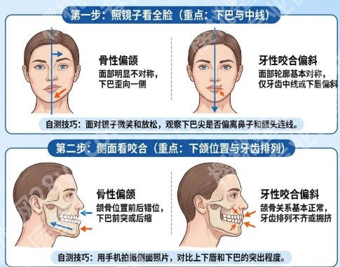 上海偏颌医生排行榜新鲜出炉!技术、口碑、价格全面解析!