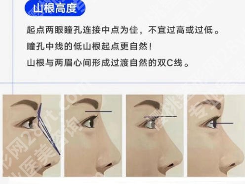 广州隆鼻医院排名榜单公示！哪家医院做得好？2026红榜来袭！