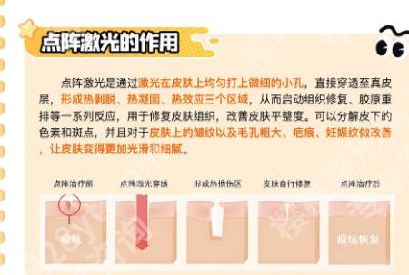 安庆市立医院点阵激光多少钱一次？全新价格表与科室医生大揭秘！