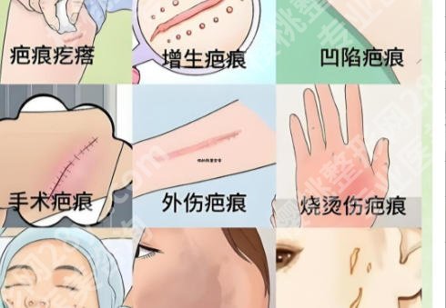 常德祛疤医院哪个好？综合实力前五强榜单实力来袭！