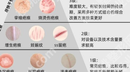 徐州除疤医院哪家好？排名前五名单及专业点评！