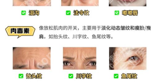 打除皱注射杭州哪家医院好？盘点5家及口碑医院全解析！