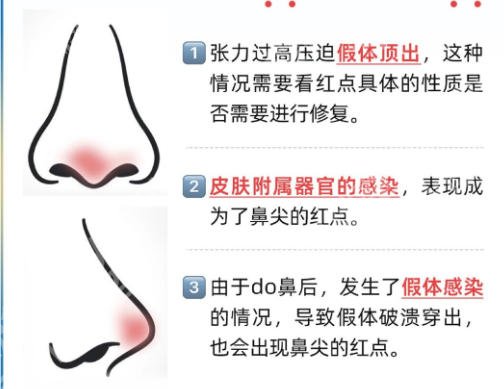 廊坊鼻修复哪家医院好?排名前十口碑评测指南来袭!